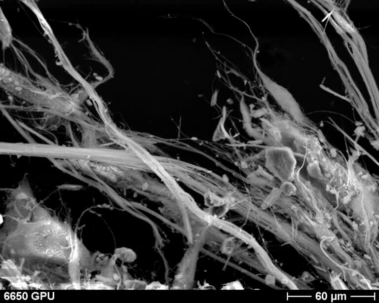 REM- Aufnahme von Asbestfasern